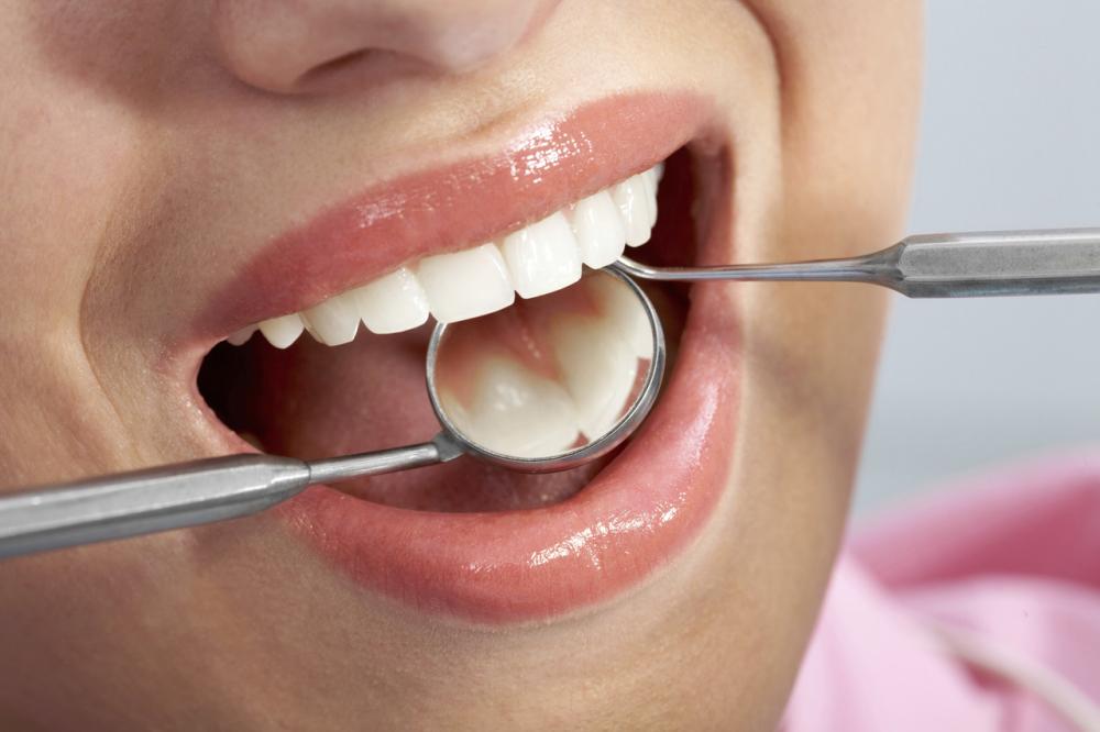 Ile kosztuje implant zęba?