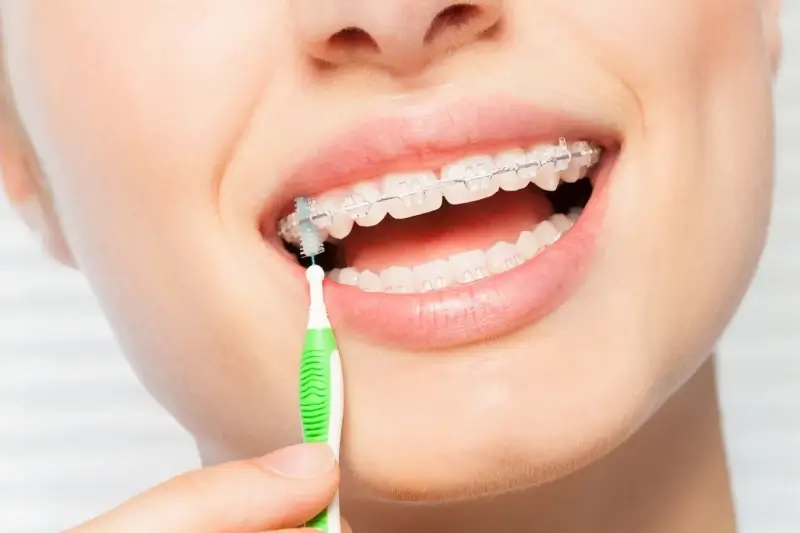 Zabiegi dentystyczne refundowane przez NFZ
