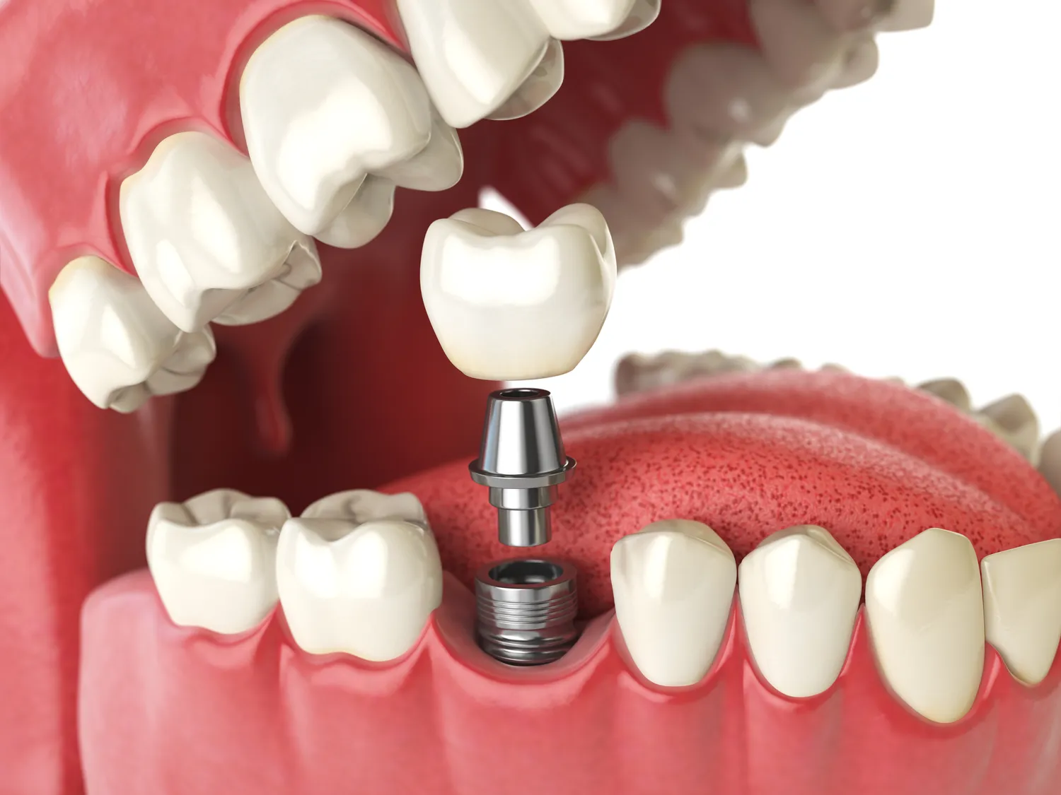 Endodoncja Szczecin