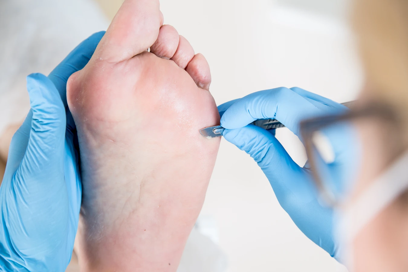 Pedicure leczniczy