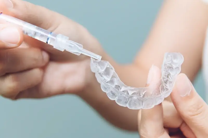 Jak długo trwa leczenie nakładkami Invisalign?