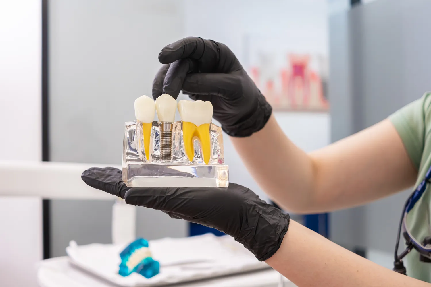 Ile kosztują implanty w Turcji?